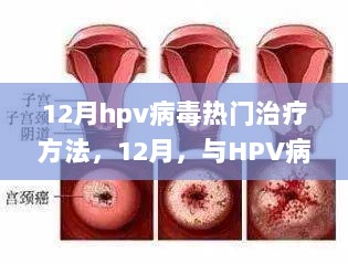 12月HPV病毒热门治疗方法，抗争勇气与智慧的励志之旅