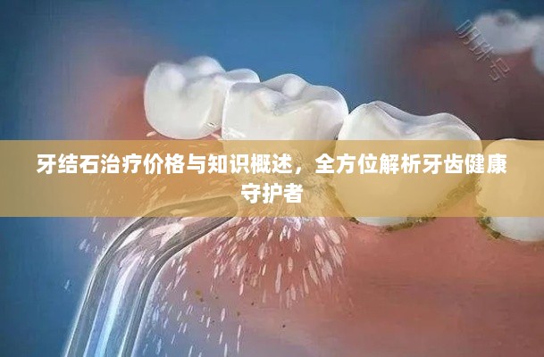 牙结石治疗价格与知识概述，全方位解析牙齿健康守护者