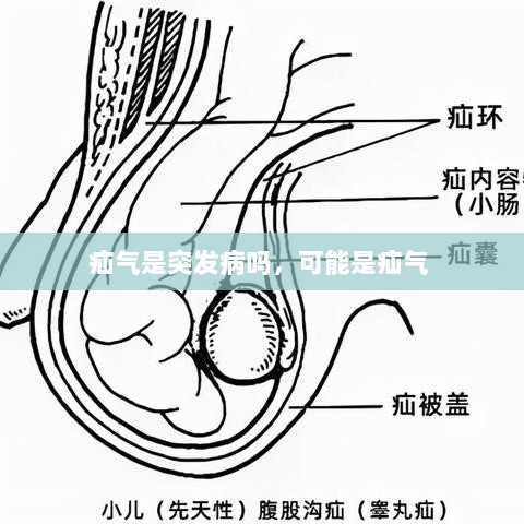 疝气是突发病吗，可能是疝气 