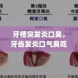 牙槽突发炎口臭，牙齿发炎口气臭吃什么药 